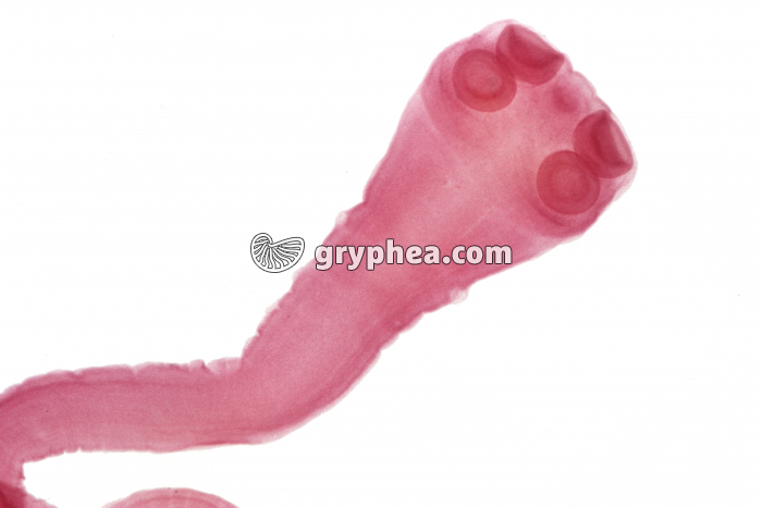 Taenia ou ver solitaire - ver parasite - Scolex entier (Taenia saginata) x5 - gryphea.org